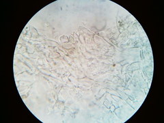 Pezicula carpinea