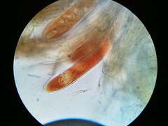 Pezicula carpinea