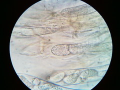 Pezicula carpinea