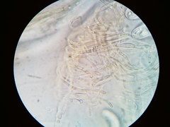 Pezicula carpinea