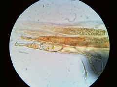 Pezicula carpinea