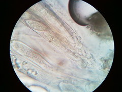 Pezicula carpinea