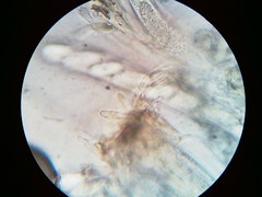 Pezicula carpinea