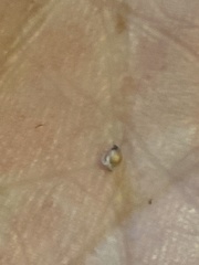 Rhynchospora plumosa