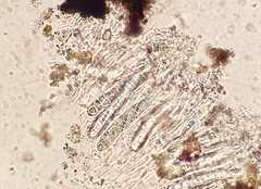 Astrothelium nigratum