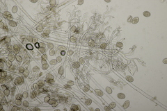 Peronospora variabilis