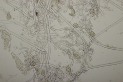 Peronospora variabilis