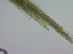 Aphanizomenon flosaquae