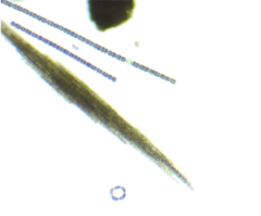 Aphanizomenon flosaquae