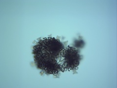 Dolichospermum lemmermannii