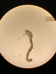 Racomitrium macounii alpinum