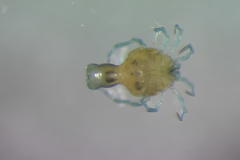 Arrenurus intermedius