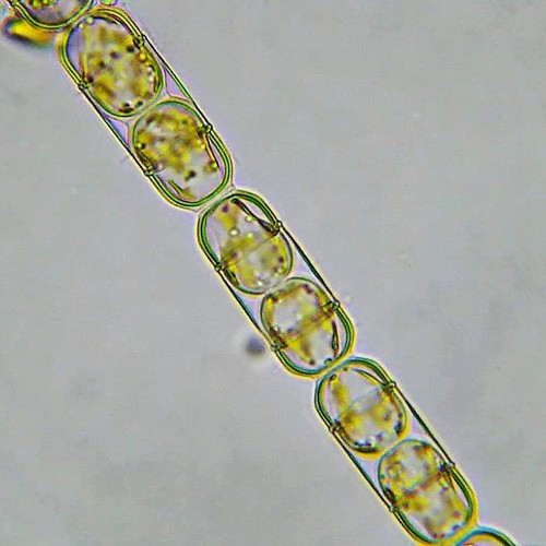 Inflexa Melosira inflexa · iNaturalist
