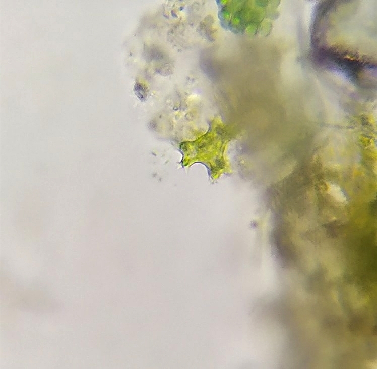 Pseudostaurastrum enorme