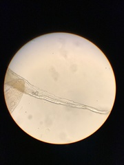 Racomitrium ericoides