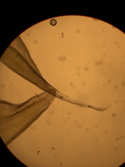 Racomitrium ericoides