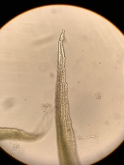 Racomitrium ericoides