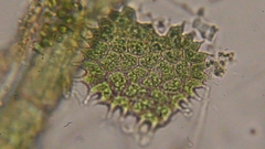Pseudopediastrum boryanum