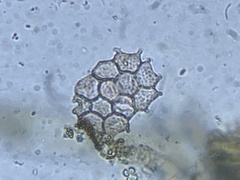 Pseudopediastrum boryanum