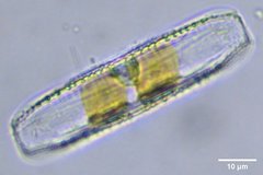 Nitzschia epithemoides