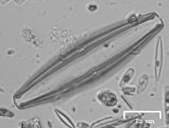 Cymbella