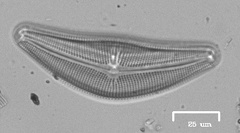 Cymbella