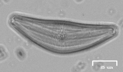 Cymbella
