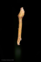 Ophthalmitis