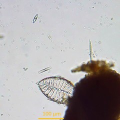 Surirella striatula