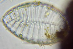 Surirella striatula