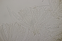 Pseudopeziza medicaginis