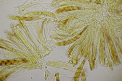 Pseudopeziza medicaginis