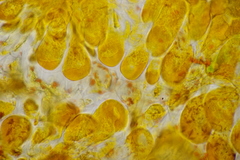 Coleosporium campanulae