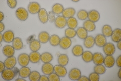 Coleosporium campanulae