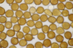 Puccinia calcitrapae