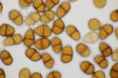 Puccinia calcitrapae