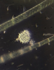 Pseudopediastrum boryanum