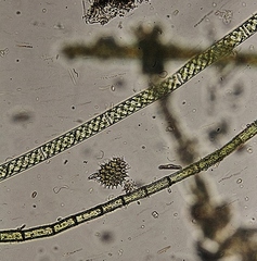 Pseudopediastrum boryanum