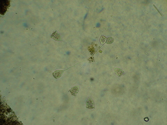 Vorticella
