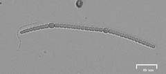 Anabaena
