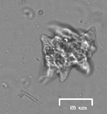 Amoeba