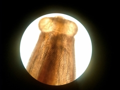 Gnathostoma binucleatum