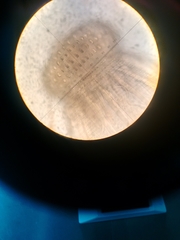 Gnathostoma binucleatum