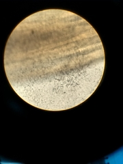 Gnathostoma binucleatum