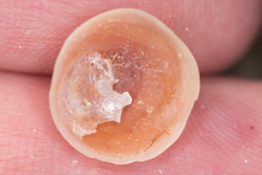 Calyptraea chinensis