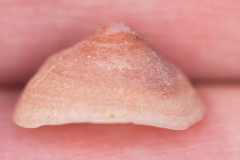 Calyptraea chinensis