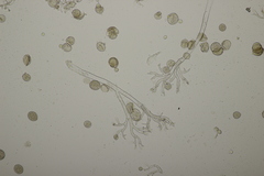 Peronospora effusa
