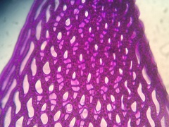 Sphagnum teres