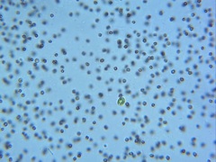 Microcystis