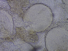 Trichoderma leucopus